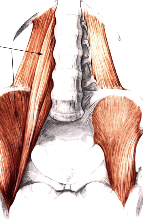 <p>what muscle is this apart of and what is the muscle</p>