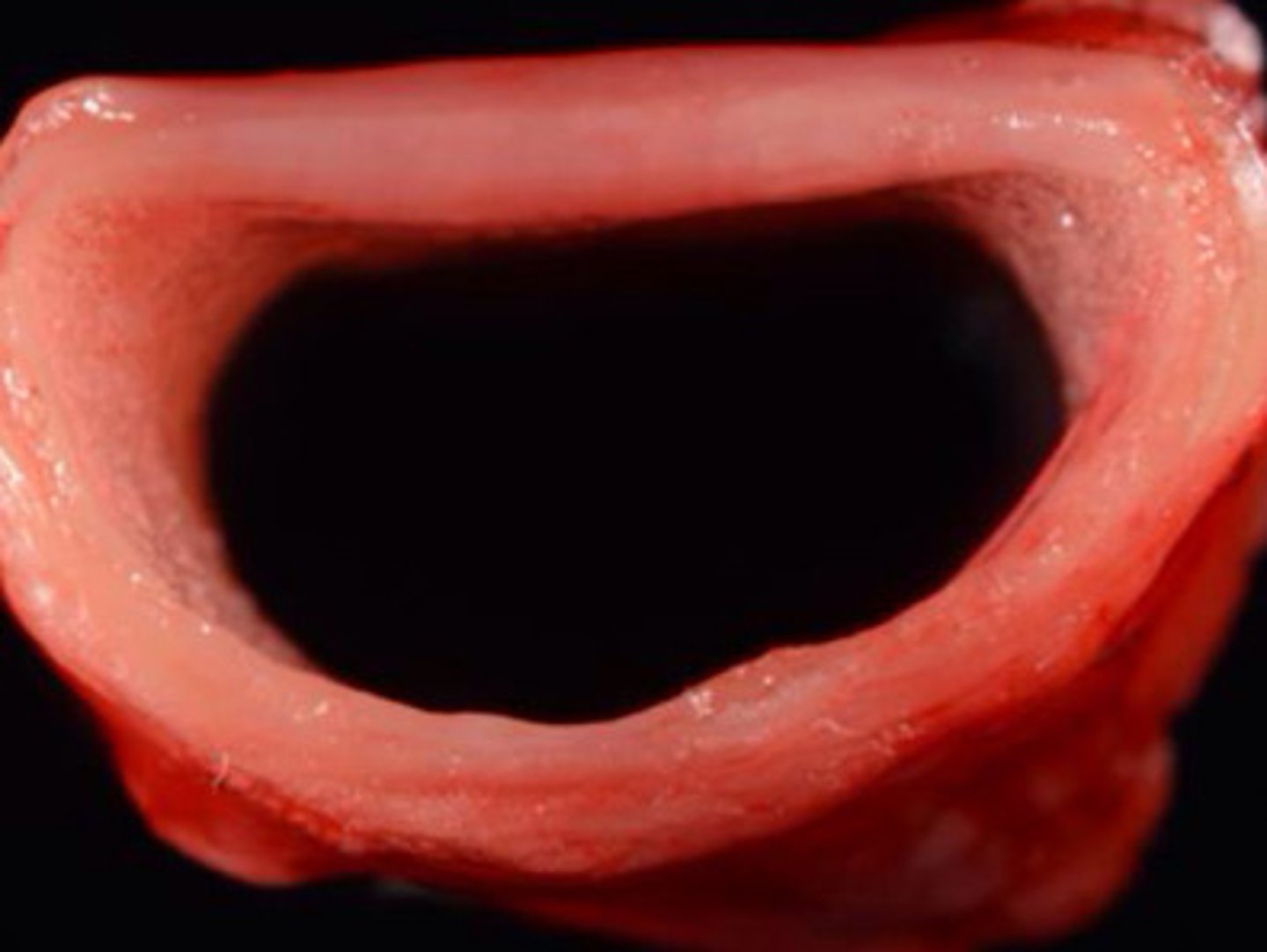 <p>Identify the pathology?</p>