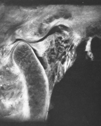 <p>what position is this TMJ in </p>