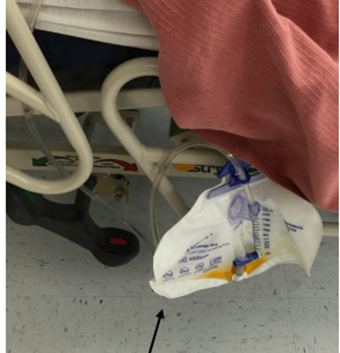 <p>inserted into bladder to remove urine from bladder</p><p>- be careful not to pull, move, or kink tube</p><p>- foley, external, suprapubic</p>