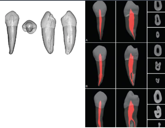 <p>BL than MD</p>