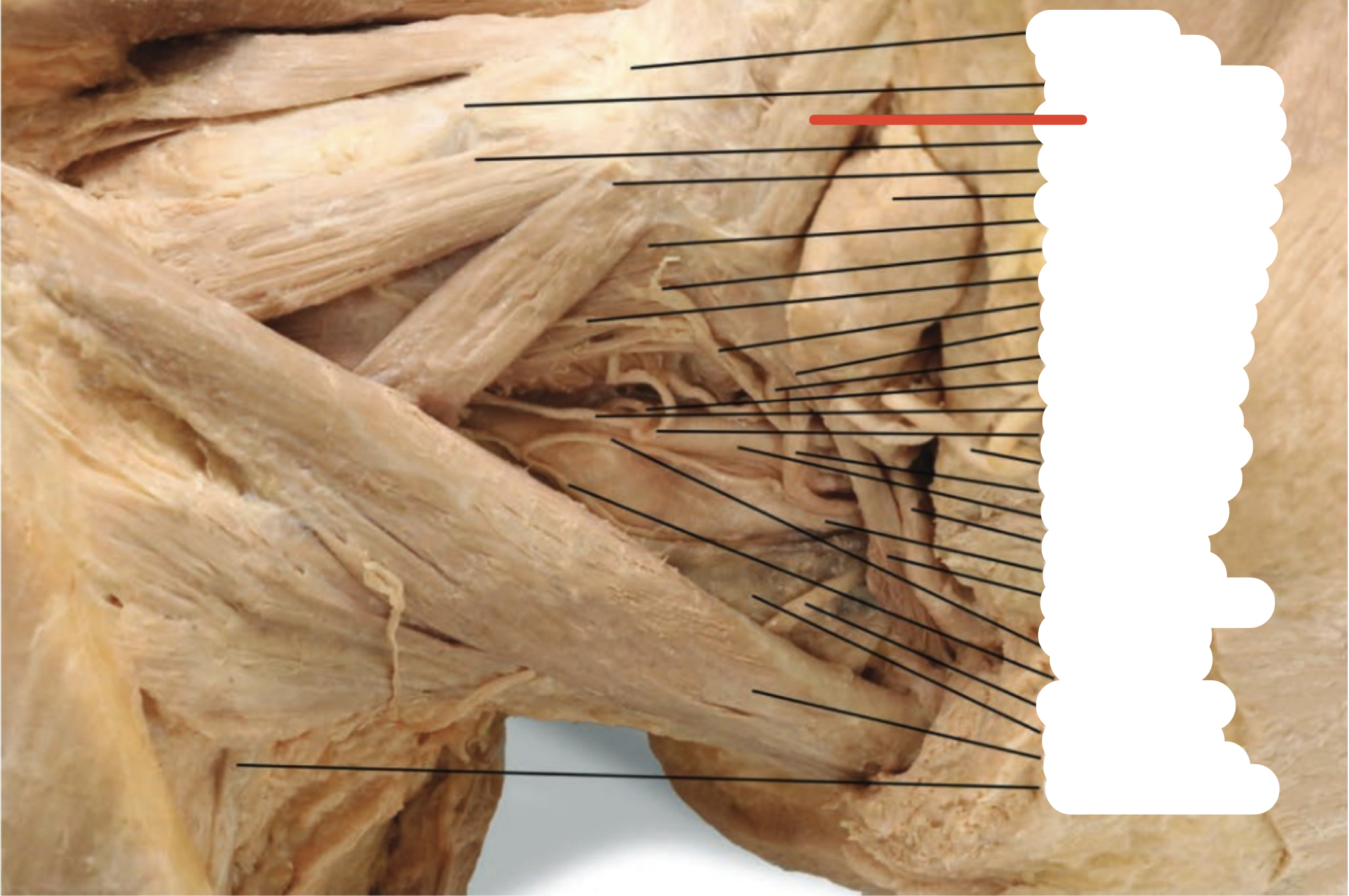 Identify the structure (red line)