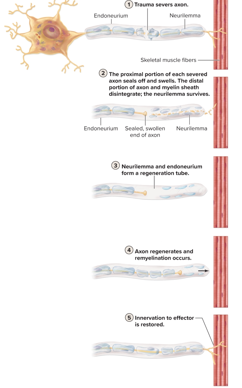 <p>Why is regeneration extremely limited?</p>