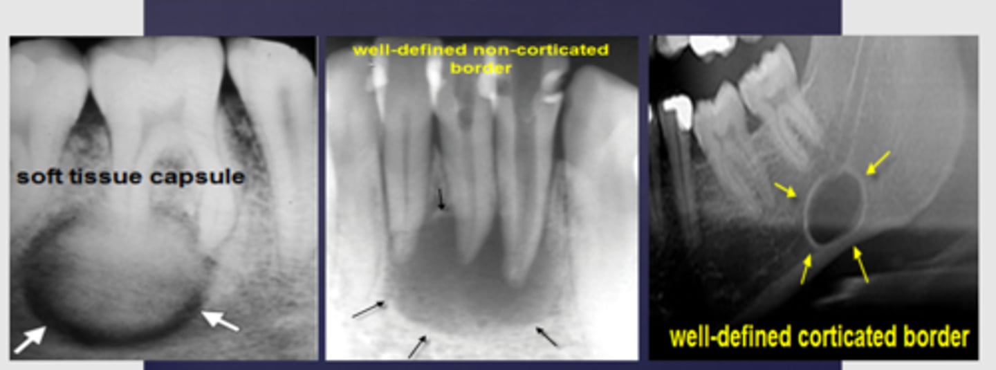 <p>Fast growing, nonvital teeth</p>