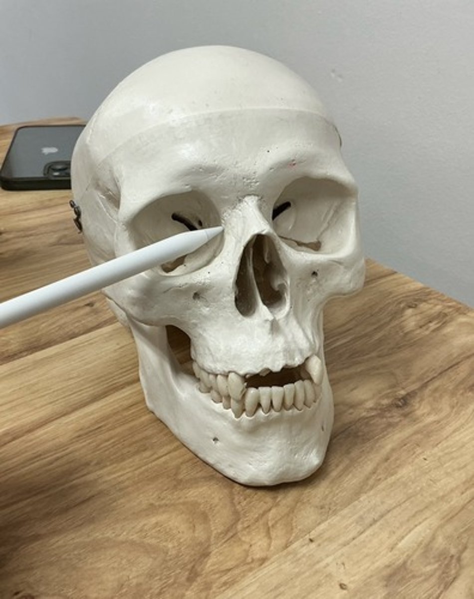 <p>What bone is this?</p>