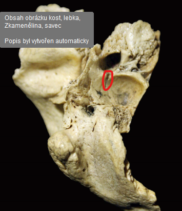 <p>prochází tudy <strong><span style="color: yellow">ramus auricularis X. - n. vagus </span></strong>- prochází okolo středoušní dutiny a inervuje <strong>ušní boltec </strong>a část <strong>zevního zvukovodu</strong></p>