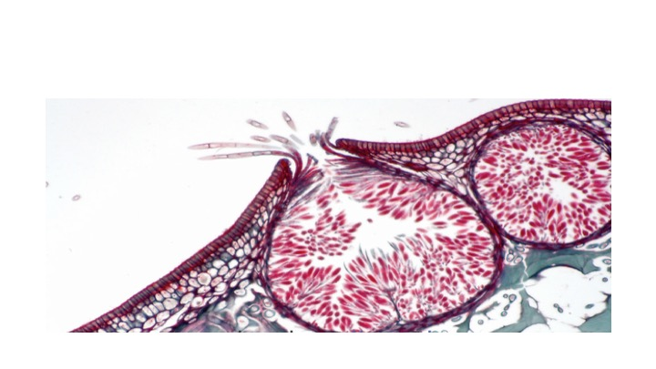 <p><span><span>What is the name of the chamber that houses these reproductive structures?</span></span></p><p><span><span>Conceptacle</span></span></p><p><span><span>Receptacle</span></span></p><p><span><span>Chamber of secrets</span></span></p><p><span><span>Ostiole</span></span></p>