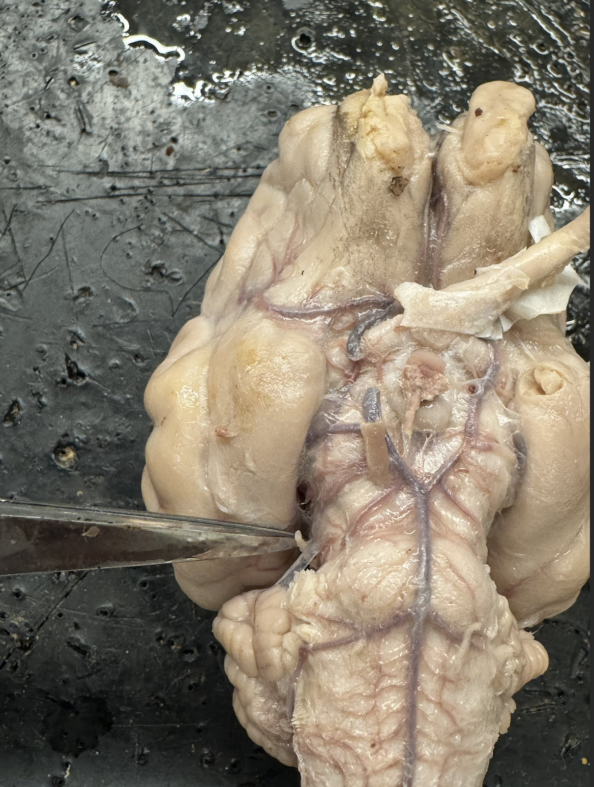 <p>what nerve is this?</p>