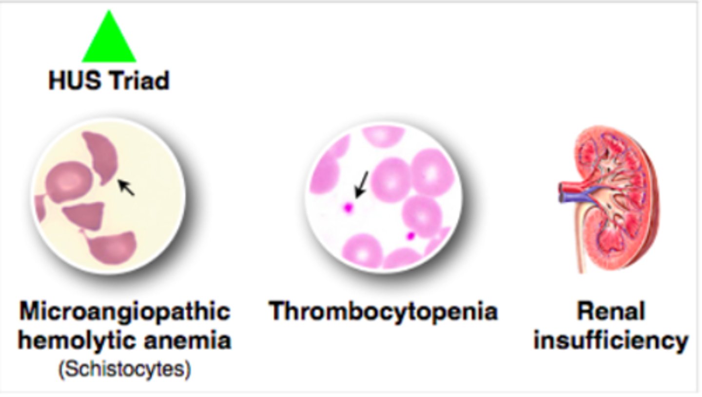 <p>Acute condition characterized by microangiopathic anemia (MAHA), acute renal insult/injury, &amp; thrombocytopenia; typically follows an E. coli O157:H7 (EHEC) infection</p>