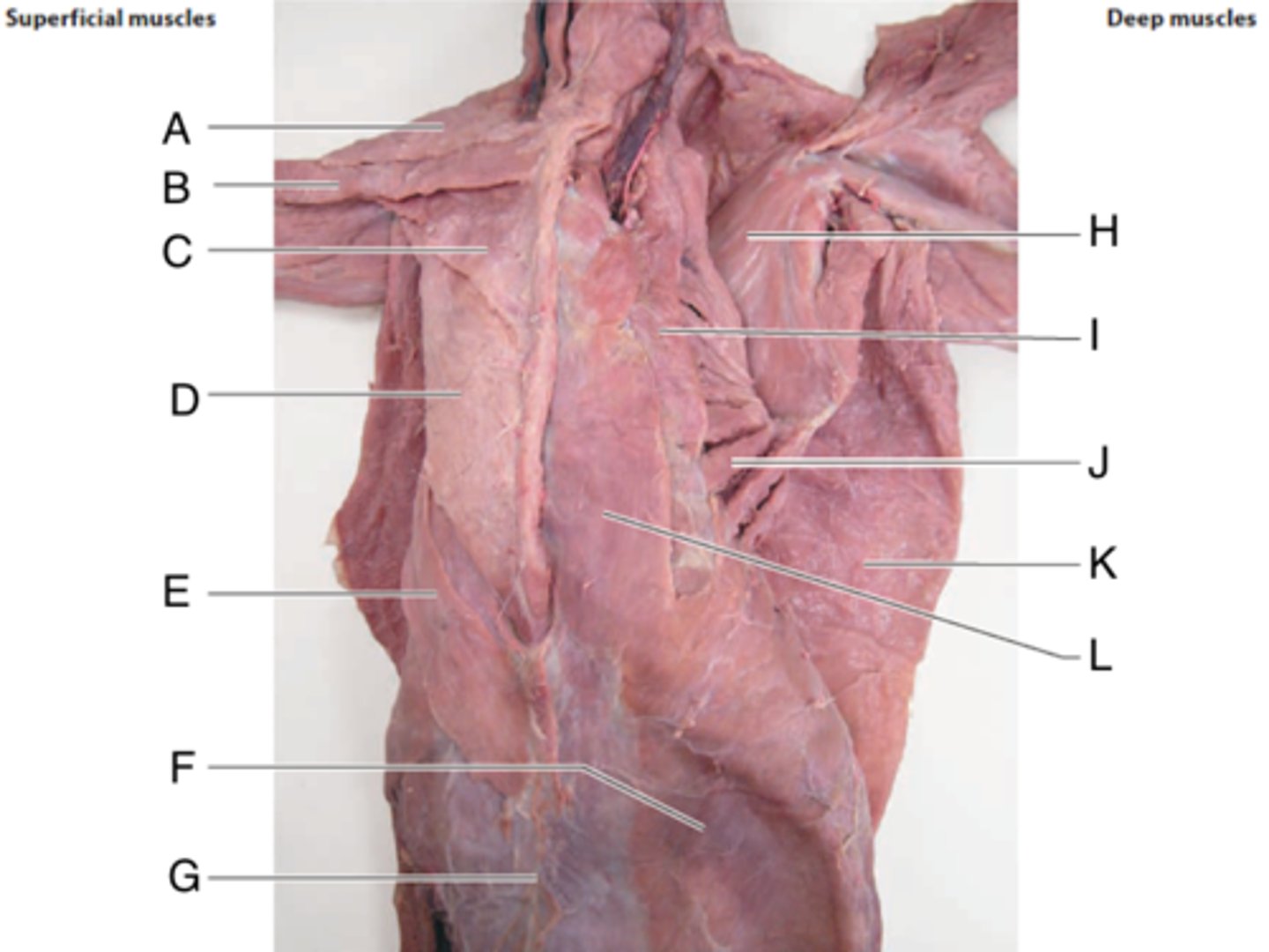 <p>What is the muscle indicated by letter H? What is an attachment point and function?</p>