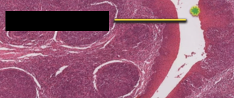 <p>help trap bacteria and foreign matter, which activates the lymphocytes</p>