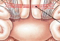 <p>Which fibers of the white matter are:</p><ul><li><p>Cross over fibers (left & right)</p></li></ul><p></p>