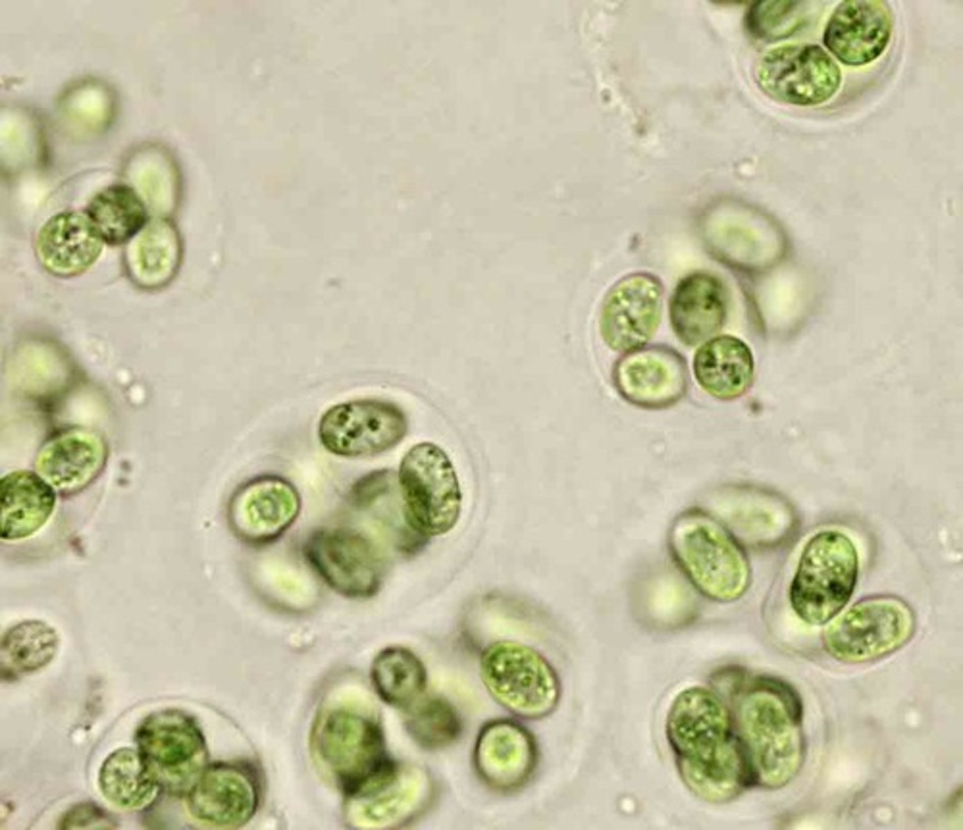 <p>unicellular form of cyanobacteria, gelatinous sheath surrounds the cell, clustered together, green color</p>