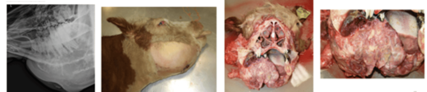 <p>- Chronic pyogranulomatous osteomyelitis with concurrent osteolysis and new bone formation</p>