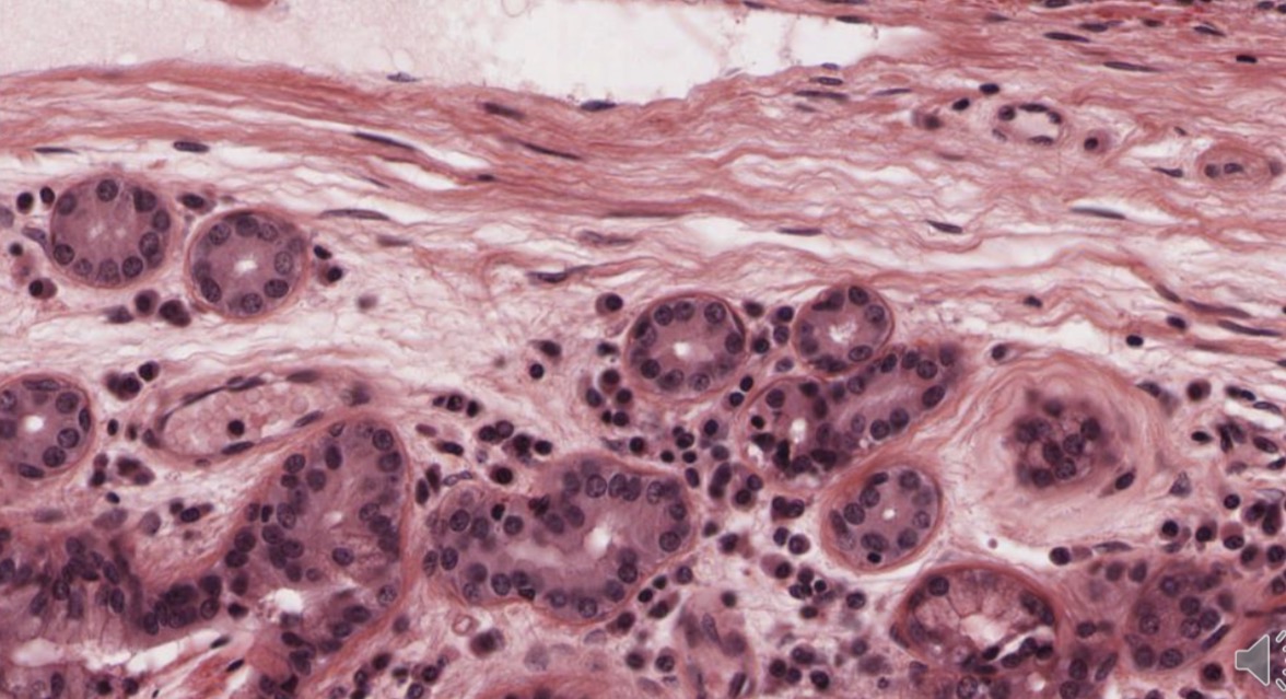 <p>Epitelio monoestratificado cúbico</p>