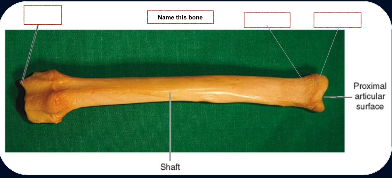 <p>Styloid process</p><p>Head</p><p>Neck</p>