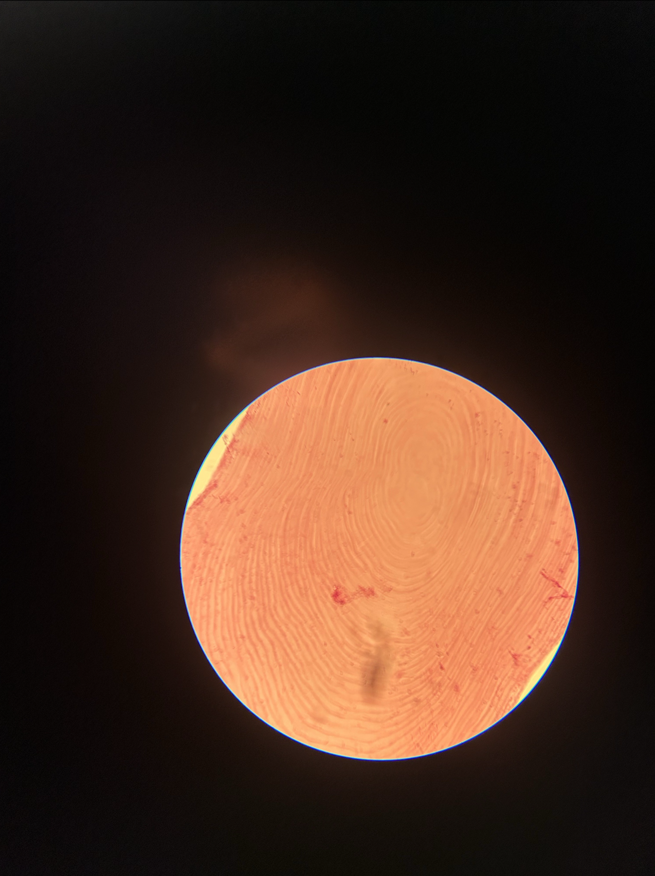 <p>what type of scale is this?</p>