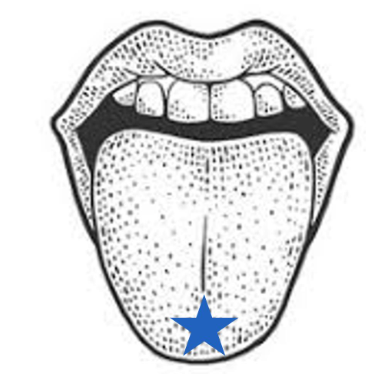 <p>Which nerve carries taste information from the area labeled with the star</p>
