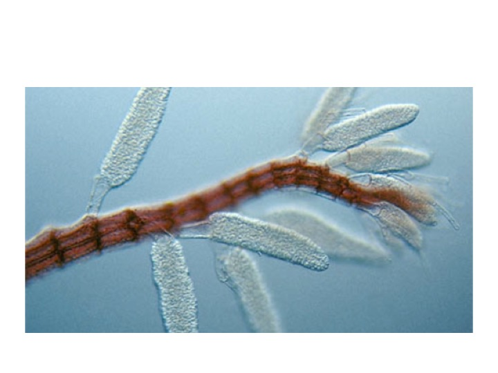 <p>What is the ploidy level of the thallus that produces the reproductive structures visible on this slide?</p><p>3N</p><p>2N</p><p>4N</p><p>1N</p>