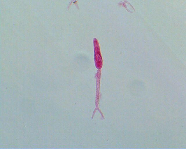 <p>Larval stage of which species? Type?</p>