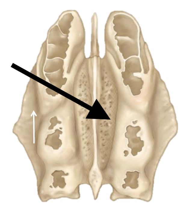 <p>Name the bone marking</p>