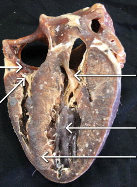 <p>middle right arrow </p>