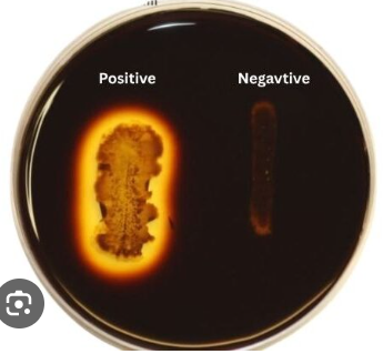 <ul><li><p><strong>Medium: </strong>Starch Agar</p></li><li><p><strong>Substrate: </strong>Starch</p></li><li><p><strong>Pathway/Enzyme:</strong></p><ul><li><p>Pathway: Hydrolysis</p></li><li><p>Enzyme: Amylase</p></li></ul></li><li><p><strong>pH. Indicator/Reagents: </strong>Indole</p></li><li><p><strong>End Products: </strong>Sugar</p></li></ul><p></p>