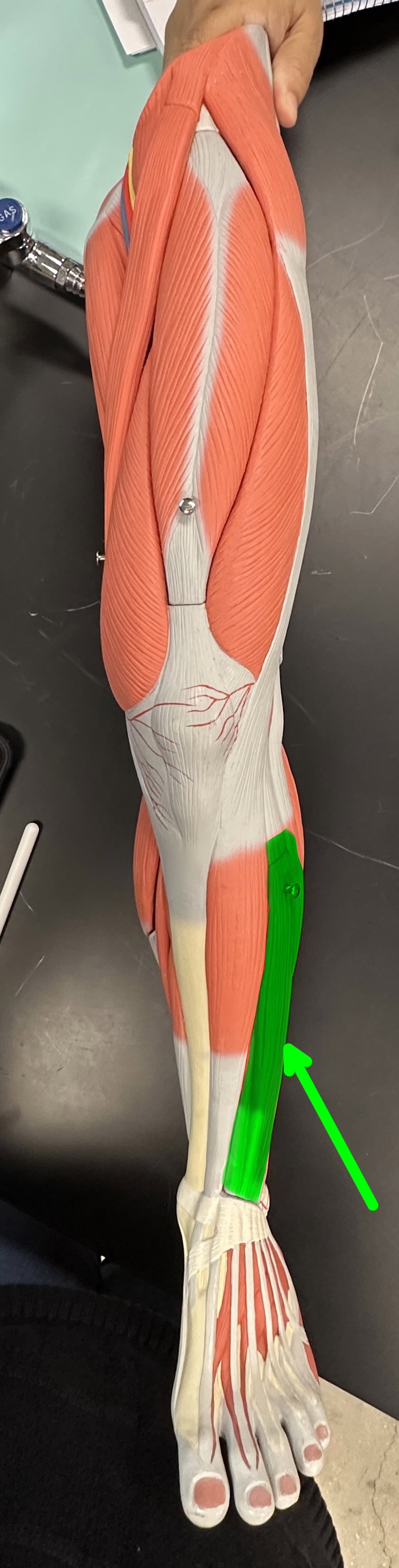 <p>What is the highlighted structure</p>