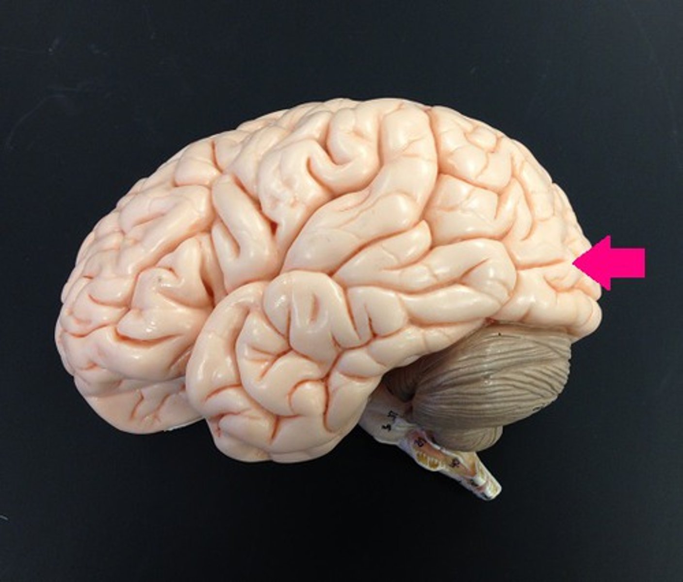 <p>Identify the lobe.</p>