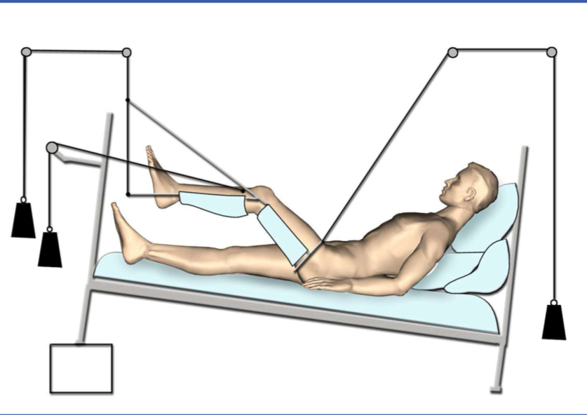 <p>What immobilizer is this?</p>