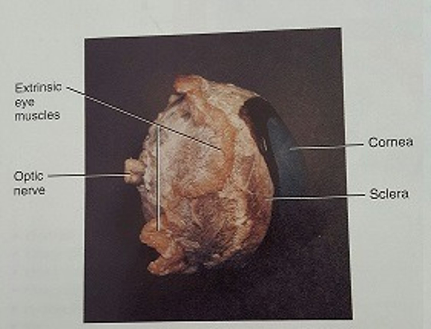 <p>-The bundle of nerve fibers that carry information from the retina to the brain.</p>