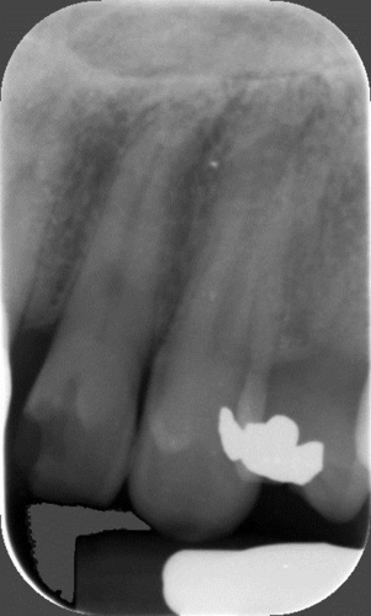 <p>What is this error?</p>