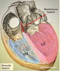 * Muscle Part
* Membranous Part 
* -------------------------------

  has 2 
  * portions 
  * Boarders