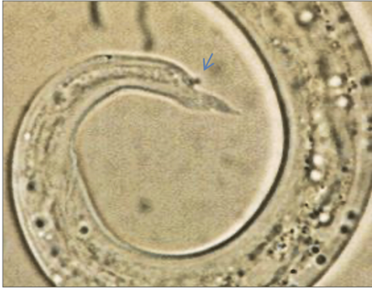 <p>Found in dog with severe pulmonary hypertension. What parasite is this?</p>