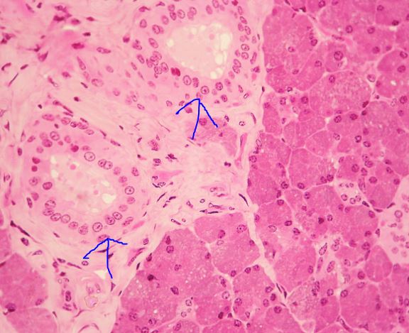 <p>What epithelial tissue is this?</p>