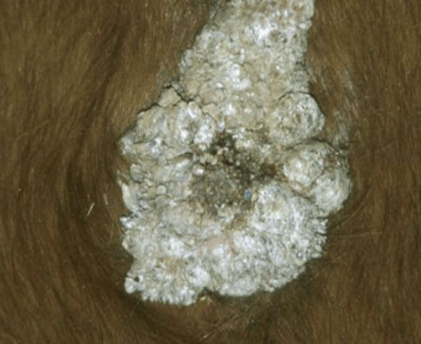 <p>What kind of sarcoid is this?</p>