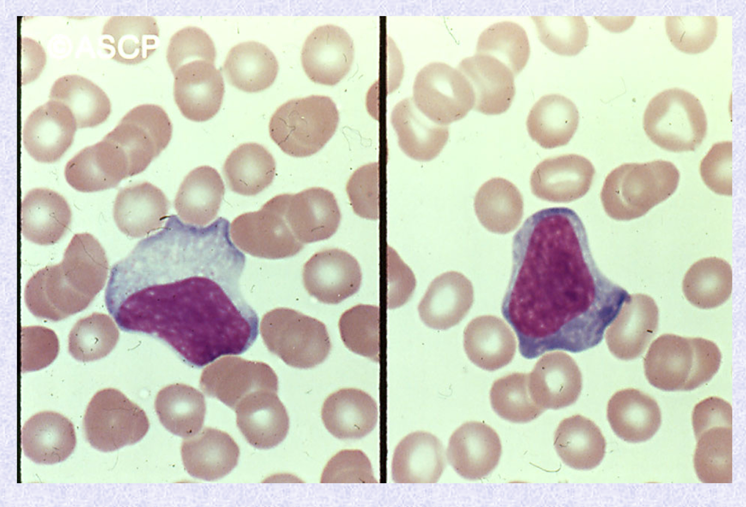 <p>What cell type is shown?</p>