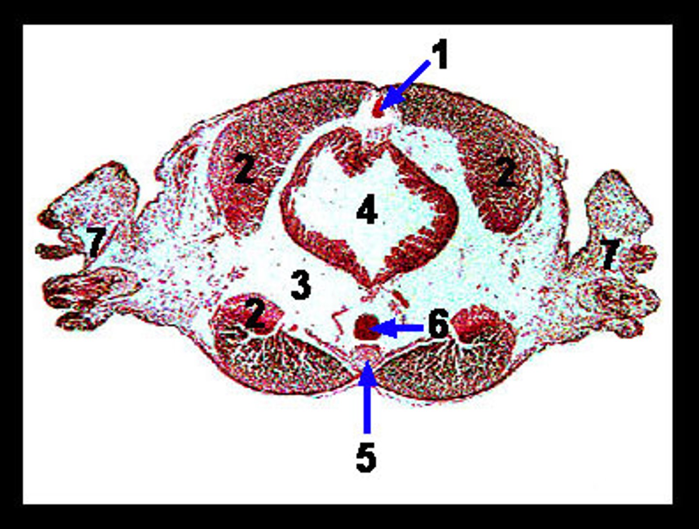 <p>houses organs, provides hydrostatic skeleton (3)</p>