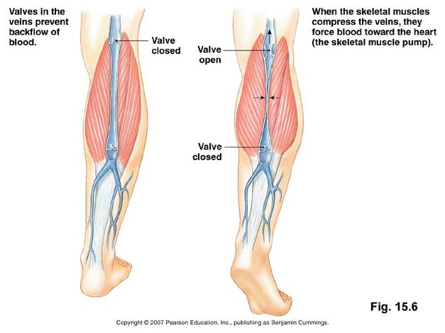 <p>Venous pooling (varicose veins)</p>