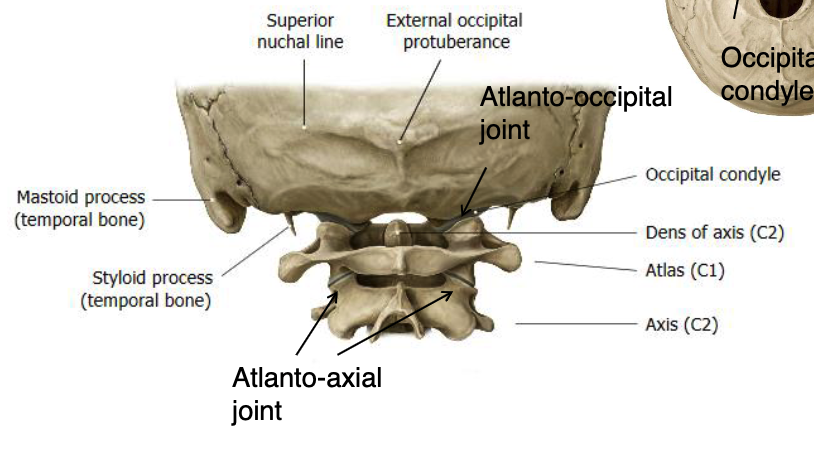 <p>atlanto-occipital joint</p>