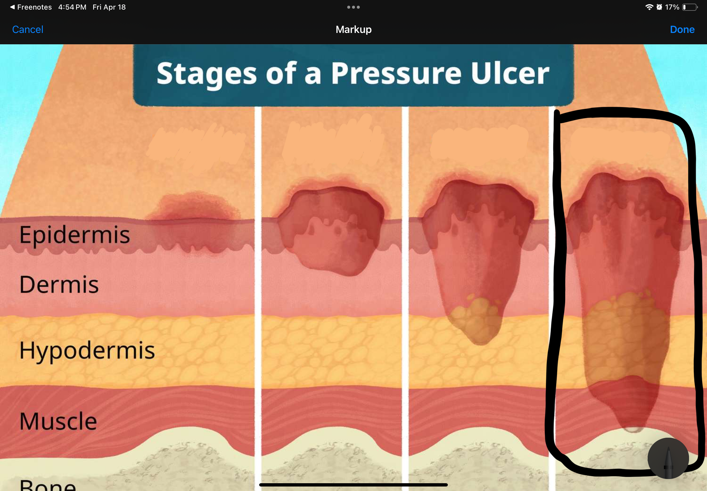 <p>Name and describe the stage of this pressure uncler</p>