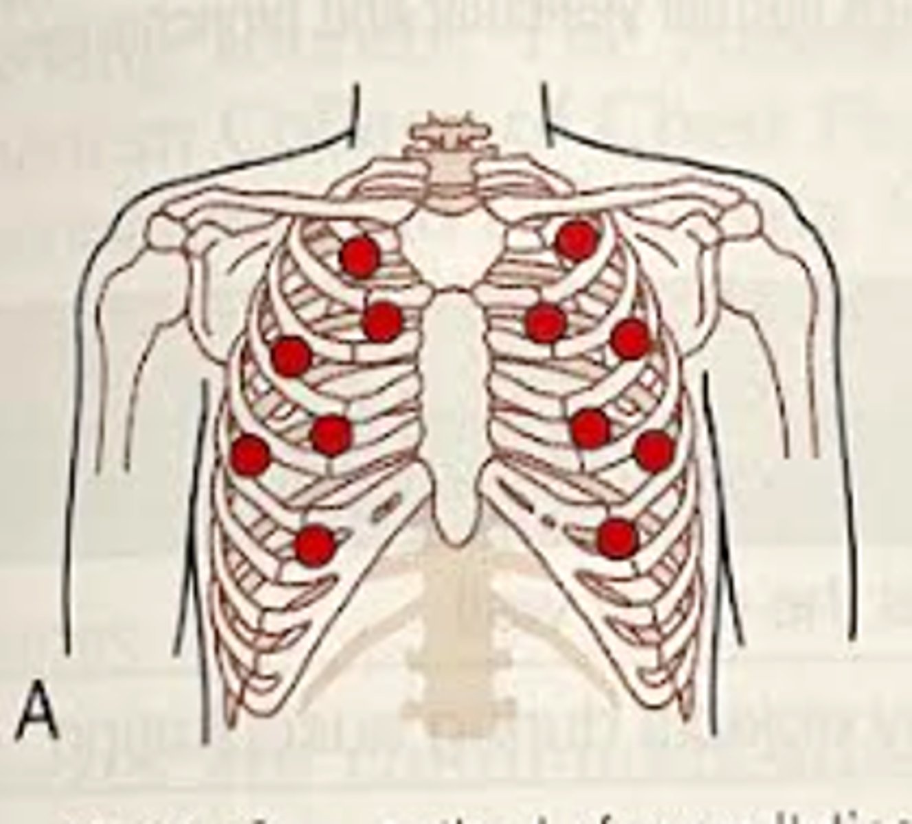 <p>Start at one side and then move to the opposite side<br>-Start at the apex of the lungs (slightly above the clavicle)<br>-2nd intercostal space midclavicular (assesses upper lobes of right and left lung)<br>-3rd intercostal space midclavicular (upper lobes of right and left lung)<br>-4th intercostal space midclavicular (right middle lobe, left upper lobe)<br>-5th intercostal space (right middle lobe, left upper lobe)<br>-6th intercostal space midaxillary (lower lobes of right and left lungs)<br>-7th intercostal space (lower lobes of right and left lungs)</p>