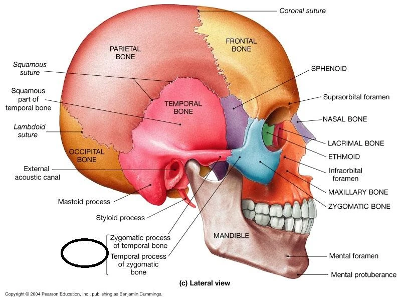 <p>zygomatic </p>