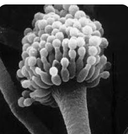 <p>Deuteromycota</p>