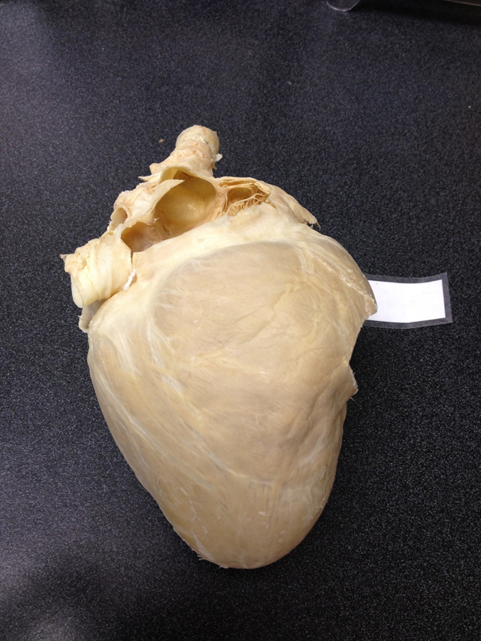 <p>Heart</p>