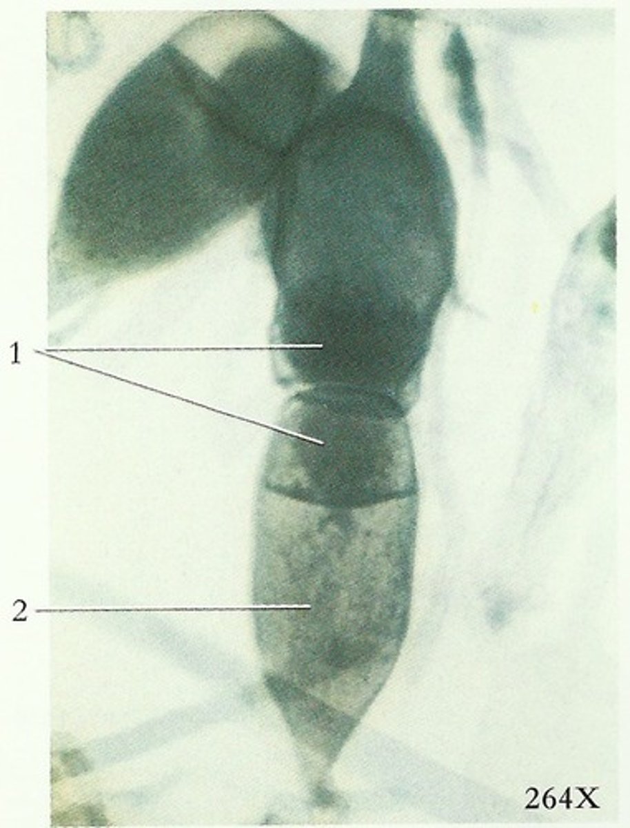 <p>fusion of two opposite mating type hyphae in zygomycetes</p>