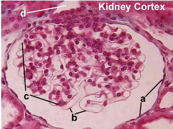 <p>a. Identify epithelial type</p><p>b. Identify epithelial type</p><p>c. Identify entire structure</p><p>d. Identify epithelium lining tubule</p>