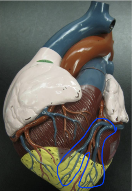 <p>anterior blue vein in anterior interventricular sulcus</p>