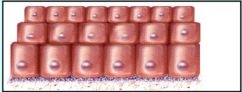 <ol start="2"><li><p>Stratified - multiple layers</p></li></ol>