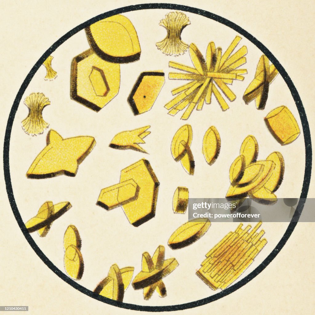 <p>Forms in acidic pH</p><p>Seen in patients with gout, chemotherapy, and Lesch-Nyhan syndrome. </p>